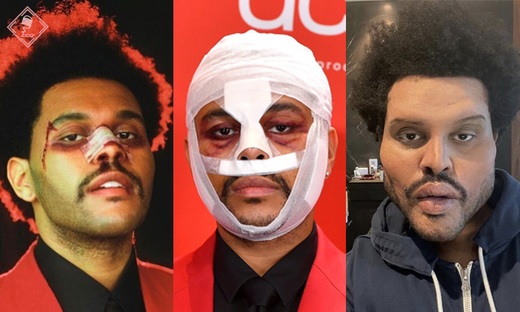 Những biến đổi gương mặt The Weeknd gần đây khiến khán giả không khỏi sốc